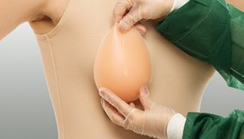3 распространённых мифа о реконструкции груди