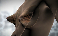 Маммопластика решает проблемы груди - Тубулярная грудь