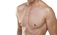 Хирургическая коррекция контуров тела - Увеличение и коррекция контуров мужской груди (пекторальные имплантаты)