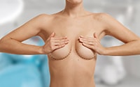 Все об увеличении груди - Установка грудного имплантата под мышцу: о чем важно знать хирургу? 